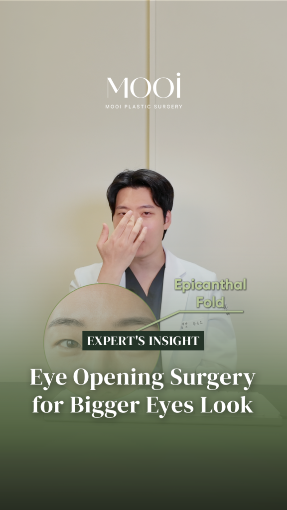 Dr. Hwang explains eye opening surgery for a bigger-eye appearance
